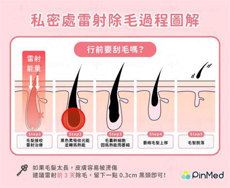 陰毛 處理|私密處除毛，你一定要知道的 10 個重要觀念